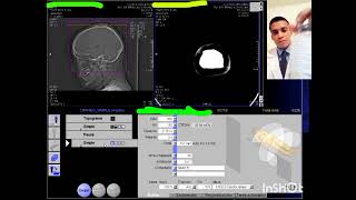 TOMOGRAFÍA MULTIDETECTOR CRANEO SC SIEMENS SOMATOM 6 CORTES [upl. by Mosra]