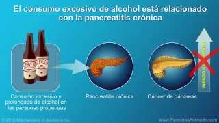 Cáncer de páncreas signos síntomas y factores de riesgo [upl. by Eesyak]