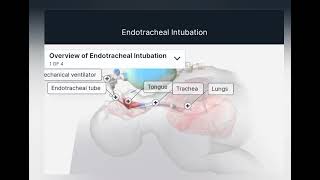 Endotracheal intubation hayatayoz [upl. by Aerdnwahs]