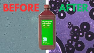 Hydrogen peroxide vs Germs under the Microscope [upl. by Huntley187]