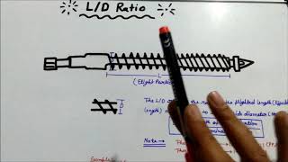 LD ratio of injection moulding machine screw [upl. by Yajet]