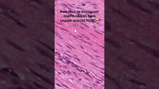 Myofibroblastsfibroblasts vs smooth muscle ￼101 histology pathology usmle [upl. by Madea]