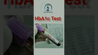 HbA1c Test  Hematology laboratory shortsvideo [upl. by Baldwin140]