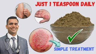 Just 1 Teaspoon Daily To Cure all Your Skin Problems  Eczema  Simple Treatment [upl. by Chadwick]