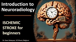 Imaging of Acute Ischemic Stroke the basics [upl. by Brannon]