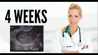 4 WEEKS ULTRASOUND 4 weeks pregnant ultrasound pregnancy ultrasound [upl. by Noryahs]