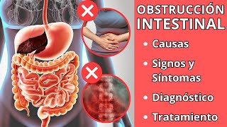 OBSTRUCCIÓN INTESTINAL  Causas signos y síntomas diagnóstico y tratamiento [upl. by Laina]