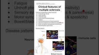 Clinical features of multiple sclerosis [upl. by Bridwell]