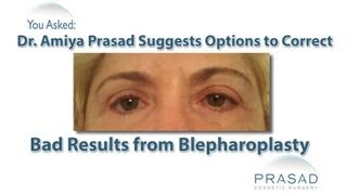 How to Correct Drooping Lower Eyelids Caused by Previous Surgery [upl. by Ahsiri]