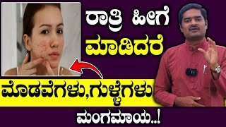 Pimples Ge Mane Maddu  ರಾತ್ರಿ ಹೀಗೆ ಮಾಡಿದರೆ ಮೊಡವೆಗಳು ಮಂಗಮಾಯ  Pimple Removal Tips  Acne Treatment [upl. by Cahra]