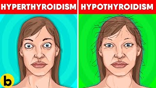 Thyroid Symptoms In Women Signs Causes amp Treatment [upl. by Eulaliah]