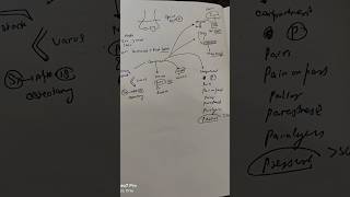 Supracondylar fracture neetpreparation orthopedics [upl. by Llerihs]