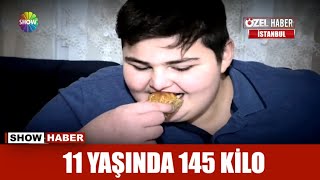 11 yaşında 145 kilo [upl. by Ardnauqal675]