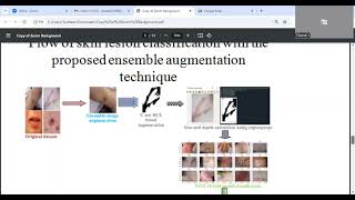 An ensemble image augmentation approach to enhance granular parakeratosis dataset [upl. by Ellehciram215]