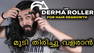 Derma Roller  കൊഴിഞ്ഞു പോയ മുടി തിരിച്ചു വളരാൻ  Hair Regrowth  LHG  English Subtitles [upl. by Ut]