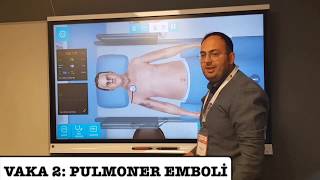 VAKA SİMÜLASYONU PULMONER EMBOLİ [upl. by Arimas]