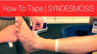 HOW TO TAPE A SYNDESMOSIS HIGH ANKLE SPRAIN [upl. by Carn]