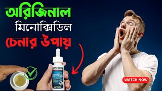 অরিজিনাল মিনোক্সিডিল চেনার উপায়Fake And Original Kirkland Minoxidil review Bangladesh [upl. by Knapp]