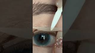 How To Put On Double Eyelids For Swollen Eyelids [upl. by Hesketh]