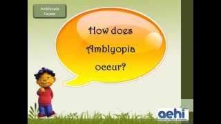 Lazy Eye Amblyopia in Children its symptoms and treatment at AEHI Navi Mumbai [upl. by Ayotas408]