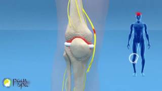 COOLIEF Genicular nerve block and radiofrequency of the Knee Joint [upl. by Arri]