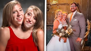 Conjoined Twins Abby and Brittany Hensel Got Married [upl. by Ibur875]