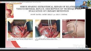 Ureteric Reimplantation tips amp tricks by Dr Ramesh Babu [upl. by Syman301]