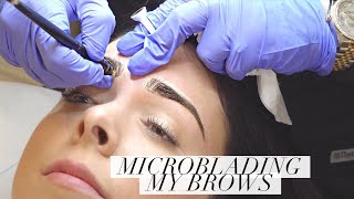 Microblading My Eyebrows [upl. by Solraced]