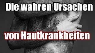 Was dir dein Arzt nicht sagt  Die wahren Ursachen von Hautkrankheiten Teil 12 [upl. by Rotberg]