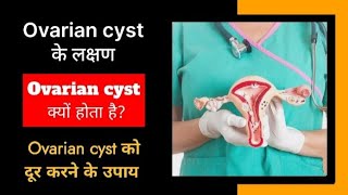 Ovarian cyst causes symptoms and treatment  Ovarian cyst से छुटकारा पाने के उपाय ovariancyst [upl. by Nicolea]