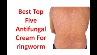 5 top antifungal cream best cream for antifungal infection watch this video for details [upl. by Aicenod301]