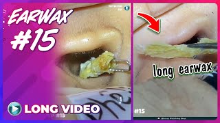 EP 15 Earwax ASMR Earwax removal video will make you relax Keep your ears clean [upl. by Seppala]