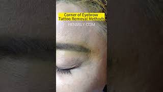 Eyebrow Tattoo Removal Before And AfterPicosecond Laser Tattoo China Laser Beauty Machine Supplier [upl. by Bernete836]