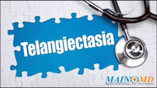 Telangiectasia ¦ Treatment and Symptoms [upl. by Dnamra]