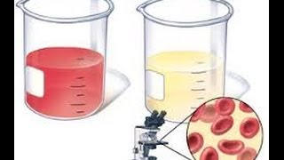 Hematuria [upl. by Teressa]