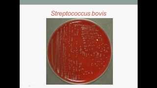 Bacteriology Streptococcus Gram Positive Cocci [upl. by Tilla613]