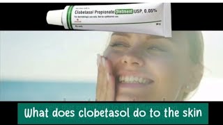 What does clobetasol do to the skin [upl. by Lubin]