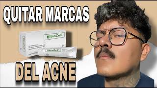 BORRAR MARCAS DE ACNE EN POCO TIEMPO  KITOSCELL [upl. by Dietsche]