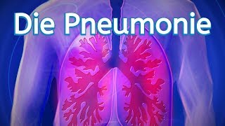 Die Pneumonie [upl. by Natty]