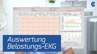 BelastungsEKG  Auswertung in der custo diagnostic [upl. by Saul]