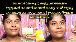 My Honest current skincare routine using Kottakkal Arya vaidhya sala products [upl. by Eleaffar]