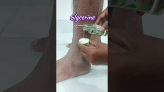 🔥Get Rid of Dry cracked Hands skincareskincaretips skincareroutine snmakeuptutoria crackedhand [upl. by Ikkaj]