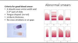 Blood smear amp Leishmans staining [upl. by Leroi]