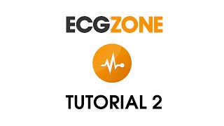 ECG Tutorial 2  Interpreting the ECG [upl. by Enoyrt]