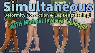 Leg Deformity Correction  Cosmetic Leg Lengthening Surgery [upl. by Terri]