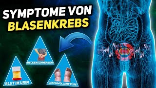 7 Symptome von Blasenkrebs die jeder kennen sollte [upl. by Nosreffej]