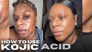 HOW TO USE KOJIC ACID SOAP WATCH THIS BEFORE USING KOJIC ACID [upl. by Nomead]