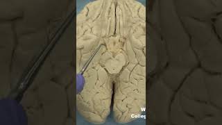 Medial temporal lobe parahippocampal gyrus neuroanatomy temporallobecortexlimbic system [upl. by Christiansen]