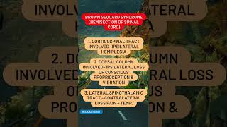 Brown sequard syndrome hemisection of spinal cord [upl. by Ronalda]