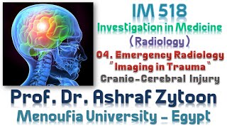 04 Undergraduate Medical Imaging and Radiology Fundamentals  CranioCerebral Injury [upl. by Ennayelhsa]